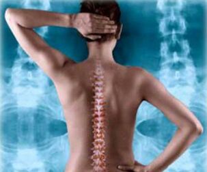 ilustracja kręgosłupa