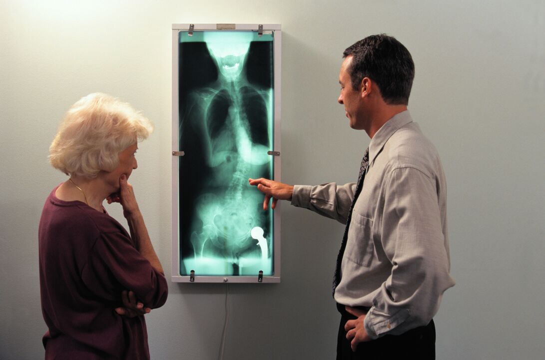 diagnostyka rentgenowska bólu stawu biodrowego