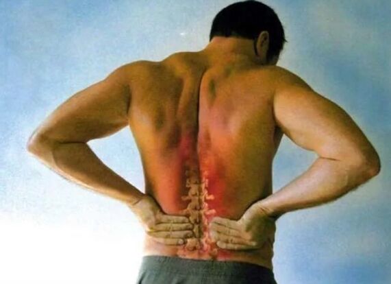 Ból osteochondrozy lędźwiowej